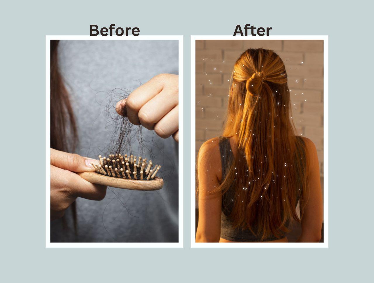 Hair Loss: How to Stop it and Regrow Hair Naturally